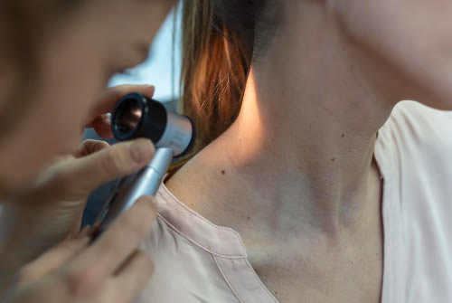 Skin Cancer: The Importance of Early Detection